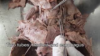 Thyroid gland  Dissection [upl. by Htnicayh]