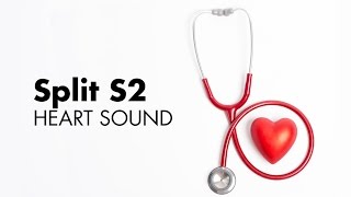 Fixed Split S2  Heart Sounds  MEDZCOOL [upl. by Cida]