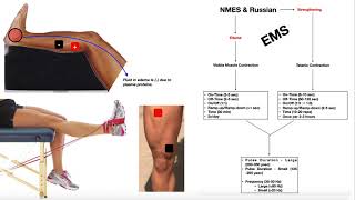 NMES amp Russian Stimulation EXPLAINED  Theory Use amp Parameters [upl. by Aseret290]