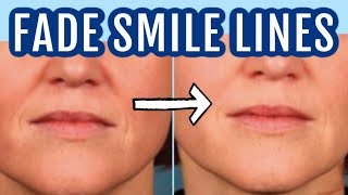 12 ways to fade smile lines nasolabial folds Dr Dray [upl. by Schoening]