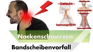 NACKENSCHMERZEN amp HWS Bandscheibenvorfall  Symptome Ursachen amp Lösungen [upl. by Zebulon130]