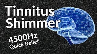 Tinnitus Shimmer  Sound Therapy Relief That WORKS [upl. by Joye567]