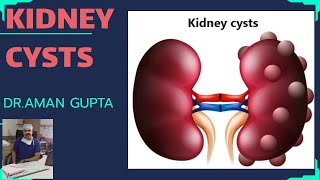 Renal or Kidney CystsSymptomsCauseTreatment [upl. by Aeneg]