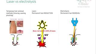 Laser hair removal vs Electrolysis [upl. by Willmert]