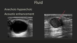 Ultrasound 101 Part 5 Terminology and Tissuesmp4 [upl. by Granlund]