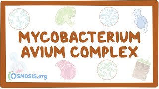 Mycobacterium avium complex  causes symptoms diagnosis treatment pathology [upl. by Champ]