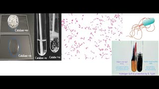 Salmonella typhi Part 1 Introduction classification biochemical tests route of transmission [upl. by Tatia]