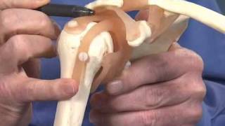 Shoulder Impingement  Dr Richard Hawkins [upl. by Gnohc48]