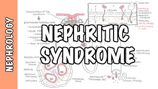 Nephritic Syndrome  classification pathophysiology treatment RPGN ANCA Immune complex [upl. by Eniawd]