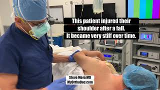 MoraMD Ortho Surgeon MANIPULATES A VERY STIFF shoulder [upl. by Barbur218]